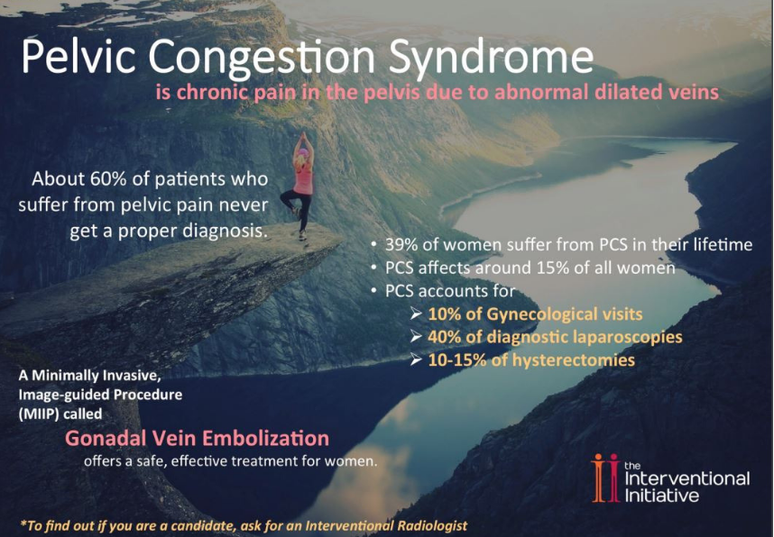 Pelvic Congestion Syndrome Treatment Near Denver Co Pcs Specialist